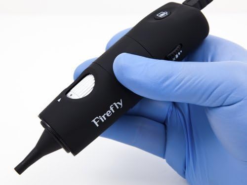 Firefly Endoscopes, Noir, Vidéo Otoscope USB Eclairage LED 50X DE500